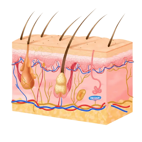 Illustration of follicles clogged by buildup